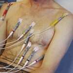 افزایش نشانگر زیستی آسیب قلبی، زنگ خطری برای خطر بالاتر زوال عقل
