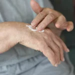 دلایل تداوم خشکی پوست حتی پس از استفاده از مرطوب‌کننده