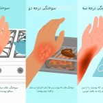اقدامات اولیه ضروری کمک‌های اورژانسی برای انواع سوختگی‌ها