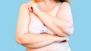 تغییرات سینه‌ها با افزایش سن: علل، عوارض و راهکارهای حفظ سلامت