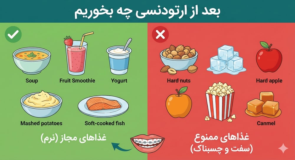 خوردنی ها بعد از ارتودنسی