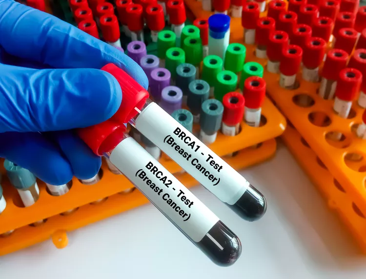 آزمایش BRCA