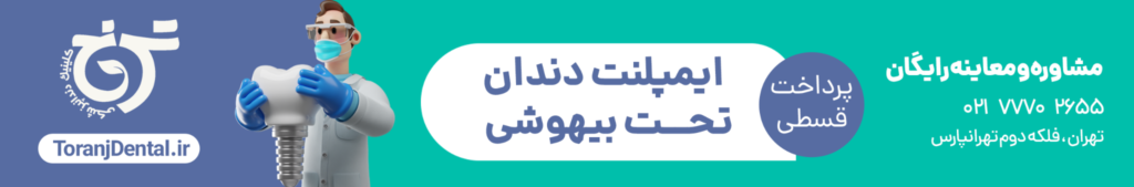 ایمپلنت دندان با بیهوشی شرق تهران