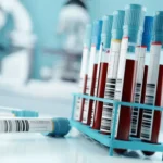 آزمایش خون جدید برای غربالگری سرطان روده بزرگ تأیید شد
