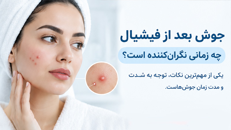 جوش بعد از فیشیال چه زمانی نگران‌کننده است؟