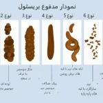 ۷ نوع مدفوع در جدول بریستول؛ کدام حالت طبیعی است؟