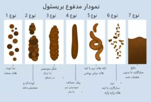 ۷ نوع مدفوع در جدول بریستول؛ کدام حالت طبیعی است؟