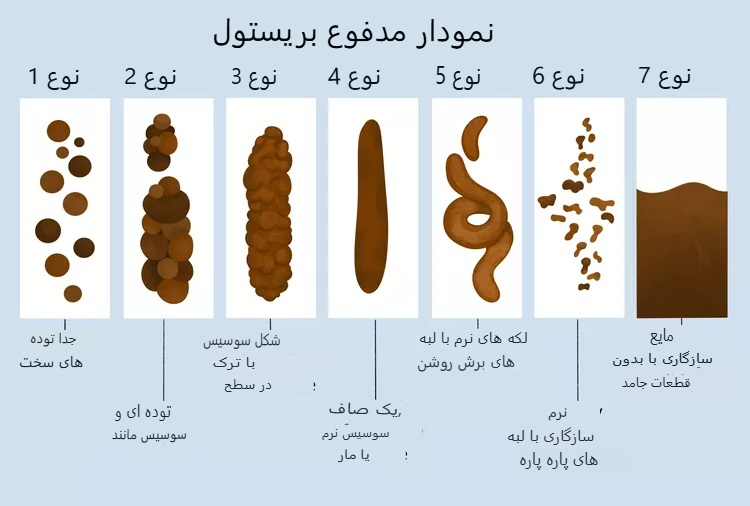 ۷ نوع مدفوع در جدول بریستول؛ کدام حالت طبیعی است؟
