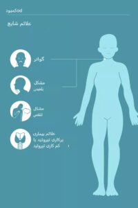علائم کمبود ید، تشخیص و روش‌های درمان آن
