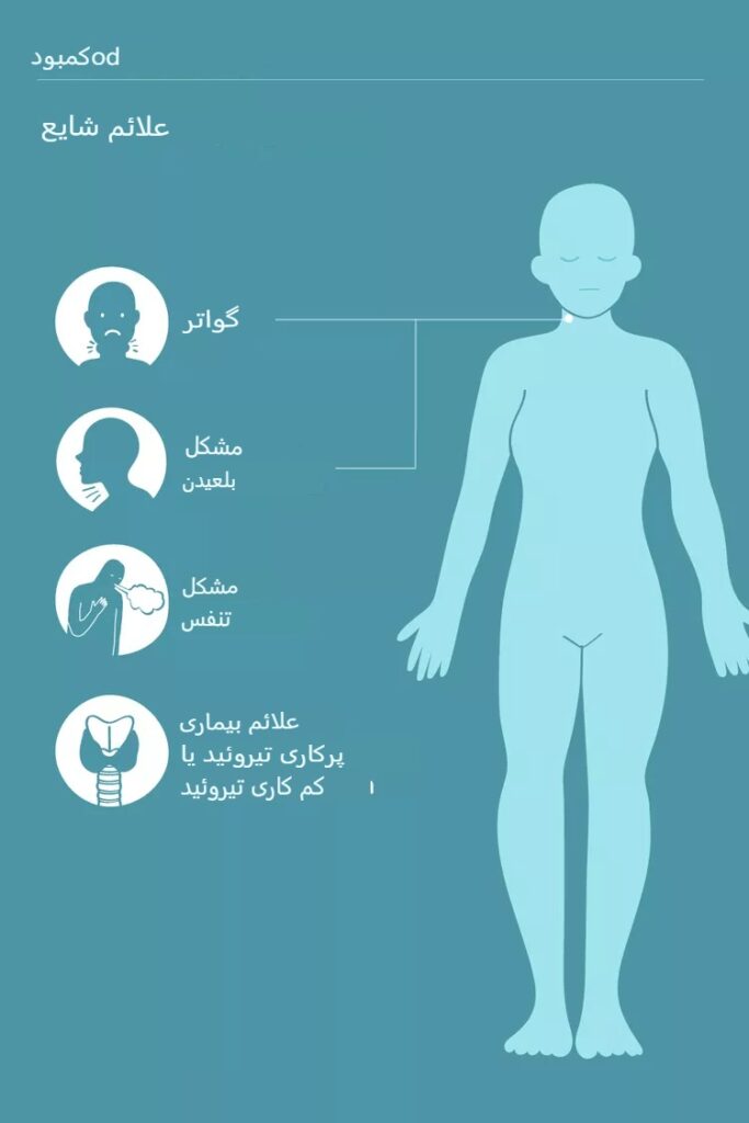 علائم کمبود ید، تشخیص و روش‌های درمان آن