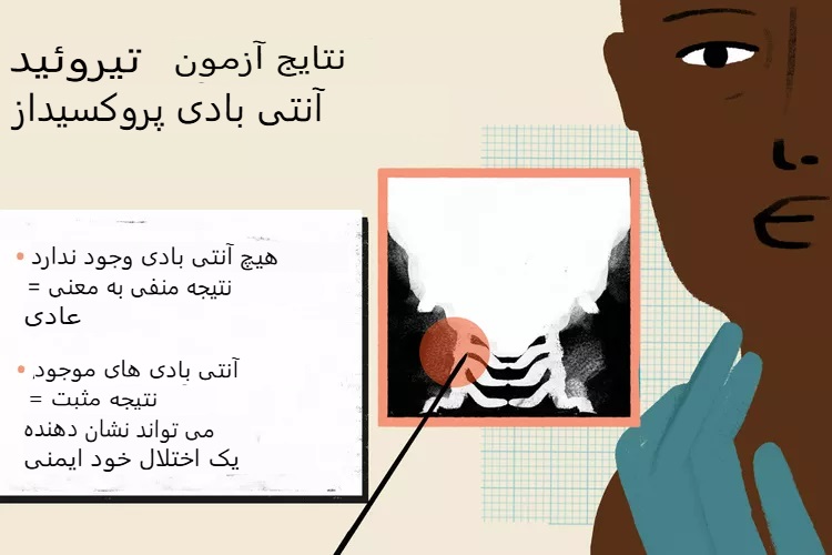 آزمایش آنتیبادی تیروئید پراکسیداز (TPO) چیست و چه کاربردی دارد؟