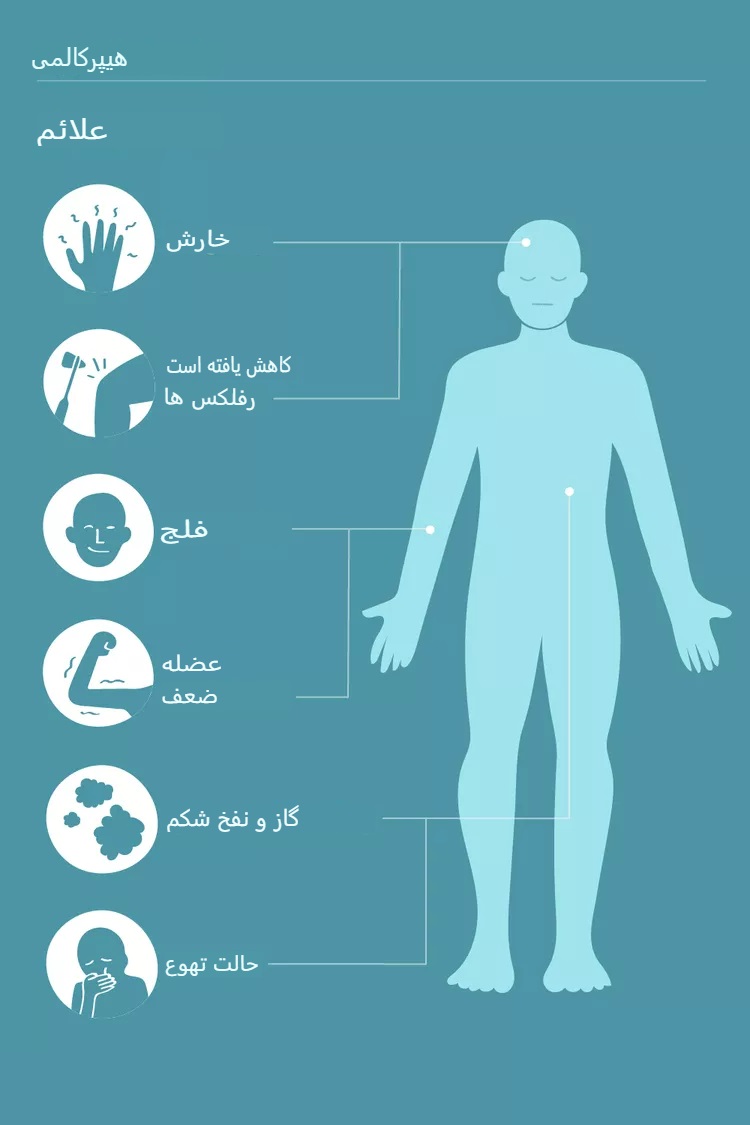 هایپرکالمی چیست؟ علائم، علل، روش تشخیص و درمان پتاسیم بالا در خون